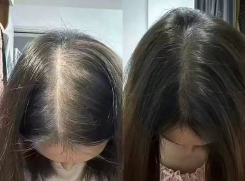 凯发app官方|露卡菲亚防脱洗发水真的能